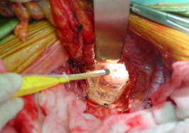 ��������p�Ŏg�p�����d�C���X���C�g�K�C�h�B���܂�����p���ʂ𖾂邭�Ƃ炵�o���A���m�Ȏ�p�̐��s�Ɋ�^���܂��B