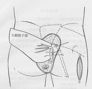 �V����p�B�A���_�o�������s�Ȃ��B